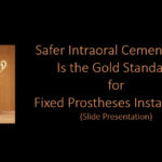 Safer Intraoral Cementation is the Gold Standard for Fixed Prostheses Installation