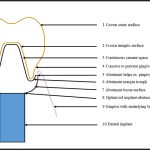 The Reverse Margin System and Supporting Concepts Designed to Make Implant Treatment Better
